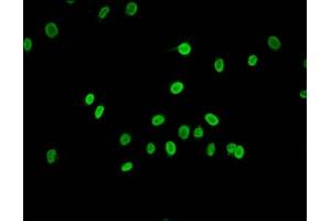 Immunofluorescence staining of Hela cells (treated with 30mM sodium butyrate for 4h) with ABIN7139160 at 1:1. (HIST1H2AG 抗体  (acLys15))