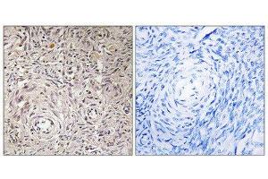 Immunohistochemistry (IHC) image for anti-Glucosaminyl (N-Acetyl) Transferase Family Member 7 (GCNT7) (C-Term) antibody (ABIN1850894) (GCNT7 抗体  (C-Term))