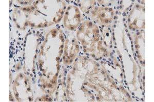Image no. 2 for anti-DnaJ (Hsp40) Homolog, Subfamily A, Member 2 (DNAJA2) antibody (ABIN1497862) (DNAJA2 抗体)