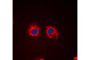 Immunofluorescent analysis of Cortactin (pY466) staining in HeLa cells. (Cortactin 抗体  (C-Term, pTyr466))