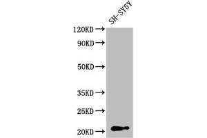 Western Blot Positive WB detected in: SH-SY5Y whole cell lysate All lanes: GNPNAT1 antibody at 1:2000 Secondary Goat polyclonal to rabbit IgG at 1/50000 dilution Predicted band size: 21 kDa Observed band size: 21 kDa (GNPNAT1 抗体  (AA 1-184))