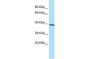 Western Blotting (WB) image for anti-ATPase, H+ Transporting, Lysosomal 38kDa, V0 Subunit D1 (ATP6V0D1) (C-Term) antibody (ABIN2774453)