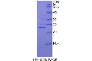 SDS-PAGE analysis of Rat Glutathione synthetase Protein. (Glutathione Synthetase Protein (GSS))