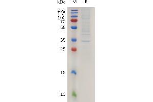 SDS-PAGE (SDS) image for Claudin 2 (CLDN2) (AA 29-78) protein (Fc Tag) (ABIN7491089)