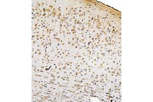 IHC analysis of SMAD2 using anti-SMAD2 antibody (ABIN6719361). (SMAD2 抗体  (AA 83-264))