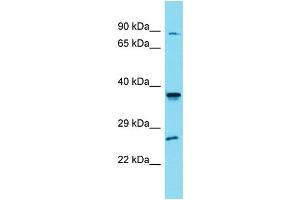 Western Blotting (WB) image for anti-Solute Carrier Family 35, Member G4 (SLC35G4) (N-Term) antibody (ABIN2791457) (SLC35G4 抗体  (N-Term))