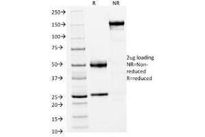SDS-PAGE Analysis of Purified, BSA-Free FOXA1 Antibody (clone FOXA1/1512). (FOXA1 抗体  (AA 372-472))