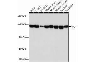 Western blot analysis of extracts of various cell lines, using VCP Rabbit mAb (ABIN7271284) at 1:1000 dilution. (VCP 抗体)