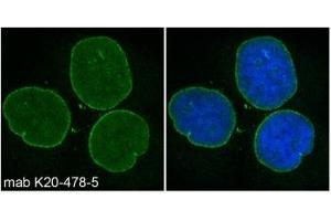 Image no. 1 for anti-Spectrin Repeat Containing, Nuclear Envelope 2 (SYNE2) (AA 1-459) antibody (ABIN1042628) (SYNE2 抗体  (AA 1-459))