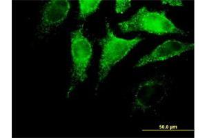 Immunofluorescence of purified MaxPab antibody to IFNA4 on HeLa cell. (IFNA4 抗体  (AA 1-189))