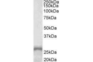 Western Blotting (WB) image for anti-Paired-Like Homeobox 2a (PHOX2A) (AA 165-179) antibody (ABIN1103585) (PHOX2A 抗体  (AA 165-179))