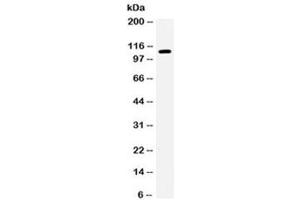 Western blot testing of human 293 cell lysate with EPHB1 antibody. (EPH Receptor B1 抗体)