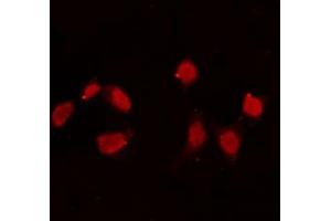 ABIN6274165 staining Hela cells by IF/ICC. (Topoisomerase II alpha 抗体  (Internal Region))