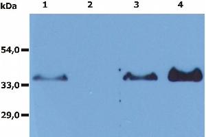 Immunoprecipitation of human CD20 from the whole cell lysate of RAJI human Burkitt lymphoma cell line. (CD20 抗体)
