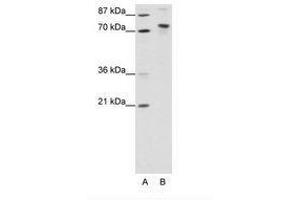 Image no. 1 for anti-TOX High Mobility Group Box Family Member 4 (TOX4) (N-Term) antibody (ABIN307424) (TOX4 抗体  (N-Term))