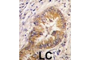 Immunohistochemistry (IHC) image for anti-Cell Division Cycle Associated 8 (CDCA8) antibody (ABIN2998016) (CDCA8 抗体)