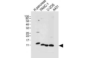 All lanes : Anti-REG3A Antibody (N-term) at 1:1000 dilution Lane 1: Human ncreas tissue lysate Lane 2: NC-1 whole cell lysate Lane 3: U-2OS whole cell lysate Lane 4: A431 whole cell lysate Lysates/proteins at 20 μg per lane. (REG3A 抗体  (N-Term))