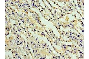 Immunohistochemistry of paraffin-embedded human lung tissue using ABIN7142914 at dilution of 1:100 (AKAP8L 抗体  (AA 1-240))