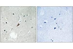 Immunohistochemistry analysis of paraffin-embedded human brain, using PYK2 (Phospho-Tyr579) Antibody. (PTK2B 抗体  (pTyr579))