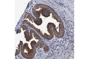 Immunohistochemical staining of human prostate with KBTBD8 polyclonal antibody  shows strong cytoplasmic positivity in glandular cells. (KBTBD8 抗体)