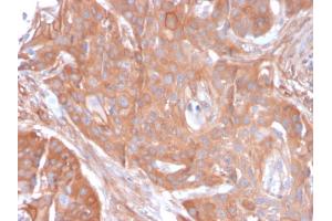 Immunohistochemistry (IHC) image for anti-5'-Nucleotidase, Ecto (CD73) (NT5E) antibody (ABIN6940229)