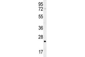 Western Blotting (WB) image for anti-HRas proto-oncogene, GTPase (HRAS) (AA 146-176) antibody (ABIN3031138)