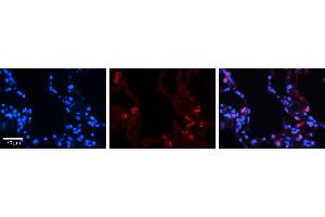 Immunohistochemistry (IHC) image for anti-Signal Transducer and Activator of Transcription 6, Interleukin-4 Induced (STAT6) (C-Term) antibody (ABIN2777200)