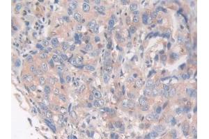 Immunohistochemistry (IHC) image for anti-Adenylyl Cyclase Associated Protein 2 (CAP2) (AA 317-455) antibody (ABIN7435160)