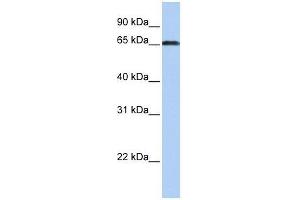 ZXDC antibody used at 0. (ZXDC 抗体  (Middle Region))