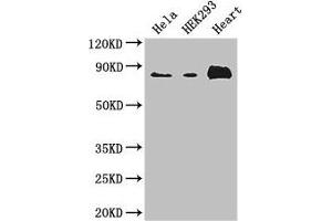 Western Blot Positive WB detected in: Hela whole cell lysate, HEK293 whole cell lysate, Mouse heart tissue All lanes: ABLIM1 antibody at 3. (ABLIM1 抗体  (AA 174-319))