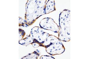Immunohistochemistry (Paraffin-embedded Sections) (IHC (p)) image for anti-Cyclophilin B (PPIB) (AA 161-195) antibody (ABIN6243144)