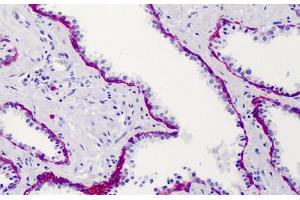 Human Prostate: Formalin-Fixed, Paraffin-Embedded (FFPE) (Syndecan 1 抗体)
