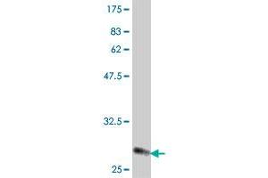 Western Blot detection against Immunogen (31. (RPL37A 抗体  (AA 2-50))