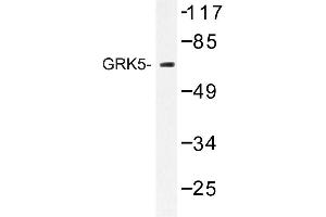 Image no. 1 for anti-G Protein-Coupled Receptor Kinase 5 (GRK5) antibody (ABIN272181) (GRK5 抗体)