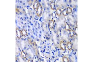 Immunohistochemistry of paraffin-embedded mouse kidney using MATK antibody at dilution of 1:100 (x40 lens). (MATK 抗体)