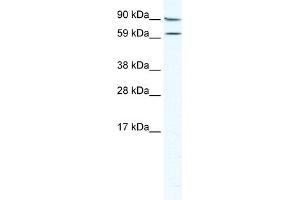 WB Suggested Anti-MTA2 Antibody Titration:  5. (MTA2 抗体  (Middle Region))
