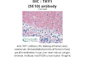 Image no. 3 for anti-CD90 (THY1) antibody (ABIN1724058) (CD90 抗体)