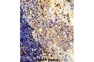 Formalin-fixed and paraffin-embedded human tonsilreacted with CD8A polyclonal antibody , which was peroxidase-conjugated to the secondary antibody, followed by AEC staining. (CD8 alpha 抗体  (N-Term))