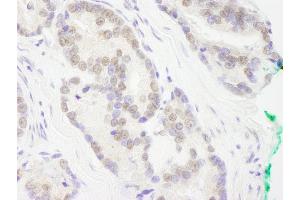 anti-REST Corepressor 3 (RCOR3) (AA 445-495) antibody