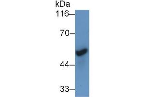 Detection of CHRNa7 in Mouse Cerebrum lysate using Polyclonal Antibody to Cholinergic Receptor, Nicotinic, Alpha 7 (CHRNa7) (CHRNA7 抗体  (AA 23-230))