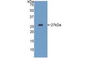 Detection of Recombinant GSTa4, Human using Polyclonal Antibody to Glutathione S Transferase A4 (GSTA4) (GSTA4 抗体  (AA 3-222))