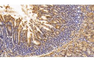 Immunohistochemistry (IHC) image for anti-Pyruvate Kinase M2 (PKM2) (AA 294-470) antibody (ABIN7438913)