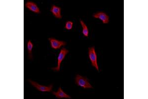 ABIN6260440 and ABIN6272875 staining HepG2 by IF/ICC. (CAMSAP2 抗体  (C-Term))