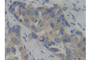 Immunohistochemistry (IHC) image for anti-phosphofructokinase, Platelet (PFKP) (AA 553-753) antibody (ABIN7434014)