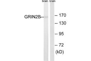 Western blot analysis of extracts from mouse brain cells, using GRIN2B (epitope around residue 1303) antibody. (GRIN2B 抗体  (Ser1303))