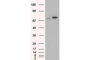 Western Blotting (WB) image for anti-Heat Shock 70kDa Protein 1A (HSPA1A) antibody (ABIN1498743) (HSP70 1A 抗体)