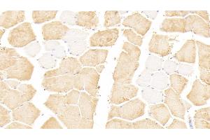 Detection of TNNI2 in Human Skeletal muscle Tissue using Polyclonal Antibody to Troponin I Type 2, Fast Skeletal (TNNI2) (TNNI2 抗体  (AA 1-182))