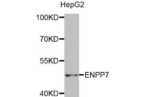 Western blot analysis of extracts of HepG2 cells, using ENPP7 antibody (ABIN5971506) at 1:400 dilution. (ENPP7 抗体)