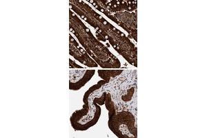 Immunohistochemical staining of human gallbladder with KIAA0753 polyclonal antibody  strong cytoplasmic positivity in glandular cells at 1:50-1:200 dilution. (KIAA0753 抗体)