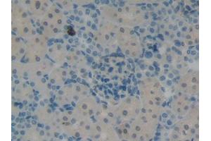 DAB staining on IHC-P; Samples: Rat Kidney Tissue (KRT12 抗体  (AA 398-456))